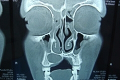 frontal-view