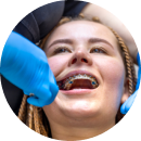 Mouth Rehabilitation